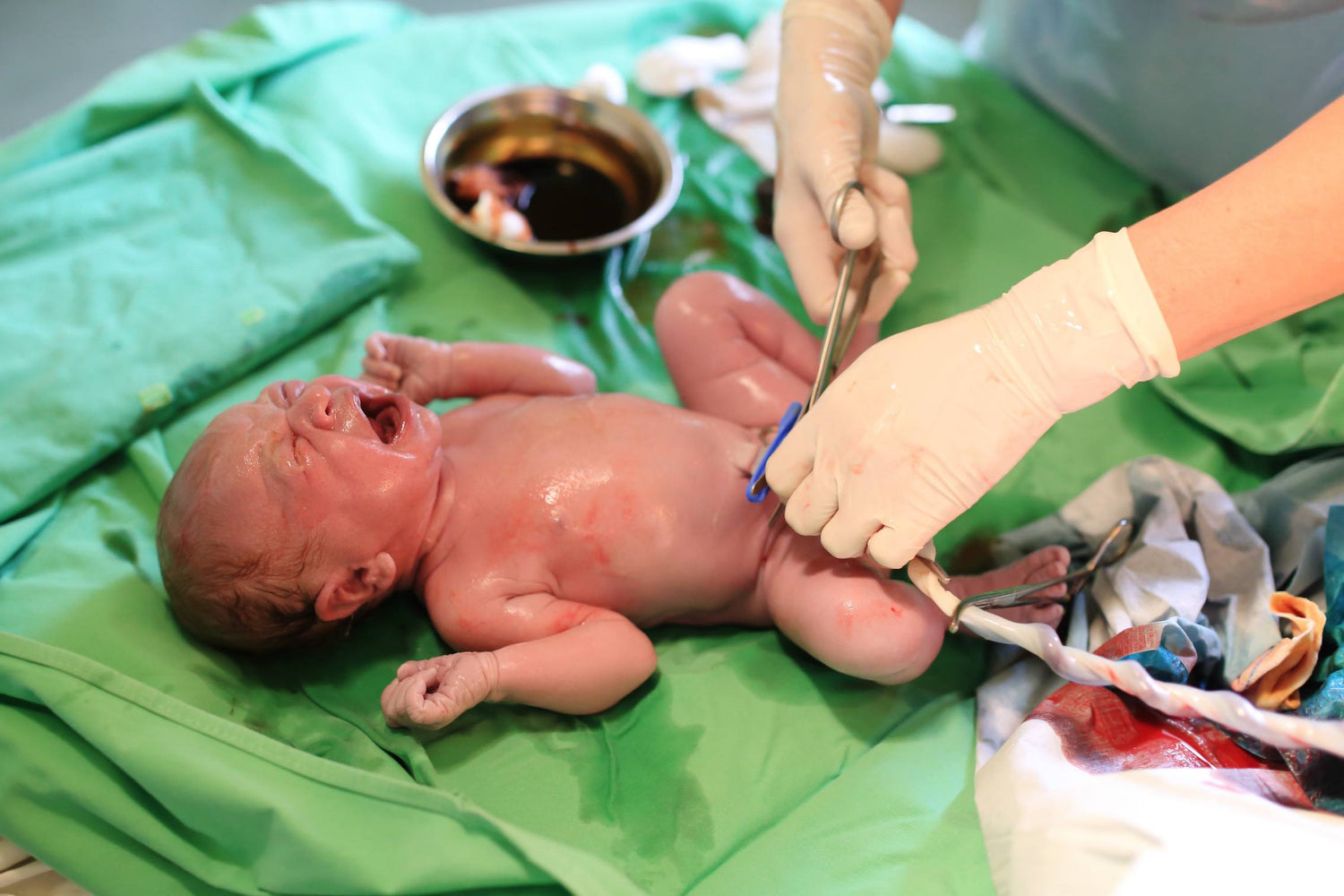 Baby nach Geburt bei Nachuntersuchung im Kreisssaal 