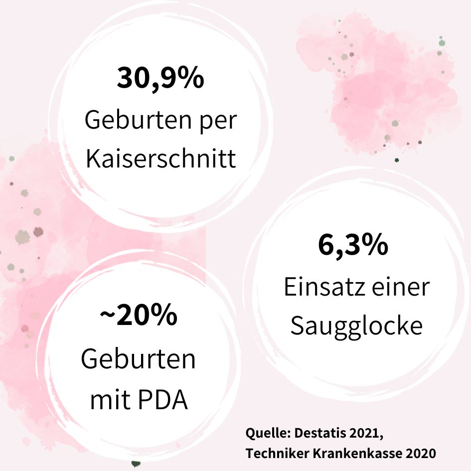 Übersicht zu Geburtenhilfen: 30,9% Kaiserschnitt, 20% PDA, 6,3% Saugglocke